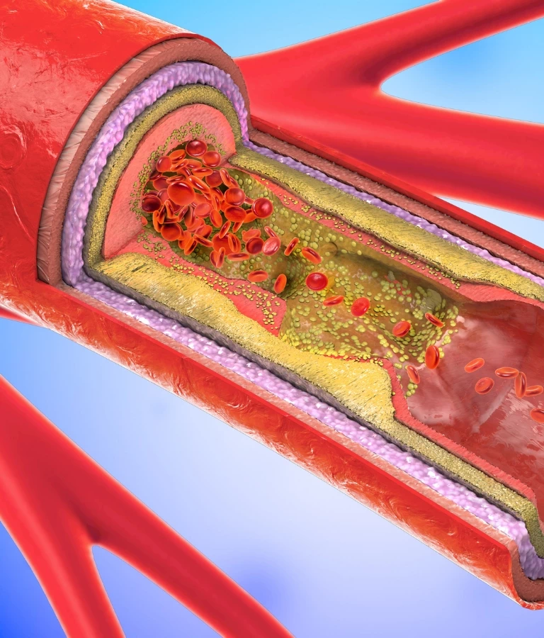 tętnice w ciele człowieka